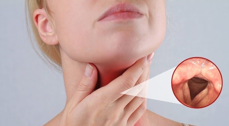 Gừng ngâm mật ong hỗ trợ điều trị viêm họng và các bệnh đường hô hấp Gừng ngâm mật ong hỗ trợ điều trị viêm họng và các bệnh đường hô hấp