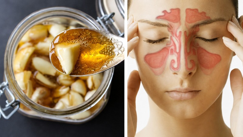 Tỏi ngâm mật ong giúp hỗ trợ sức khỏe đường hô hấp Tỏi ngâm mật ong giúp hỗ trợ sức khỏe đường hô hấp